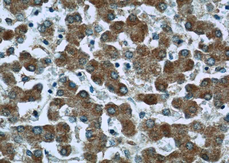 Immunohistochemistry of paraffin-embedded human liver slide using Catalog No:113050(ND1 Antibody) at dilution of 1:50