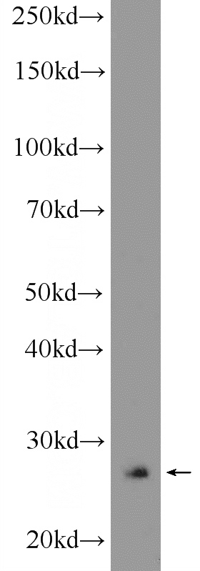 NIH/3T3 cells were subjected to SDS PAGE followed by western blot with Catalog No:113541(P27; KIP1 Antibody) at dilution of 1:600