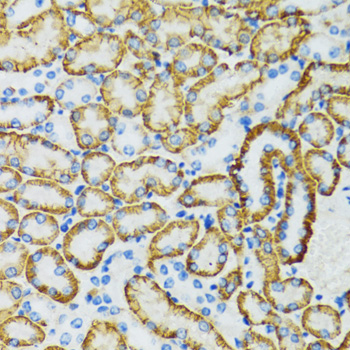 Immunohistochemistry - SLC5A1 Polyclonal Antibody 