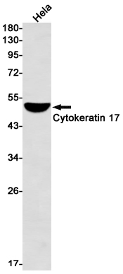 Western blot detection of Cytokeratin 17 in Hela cell lysates using Cytokeratin 17 Rabbit mAb(1:1000 diluted).Predicted band size:48kDa.Observed band size:48kDa.