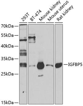 Western blot - IGFBP5 Polyclonal Antibody 