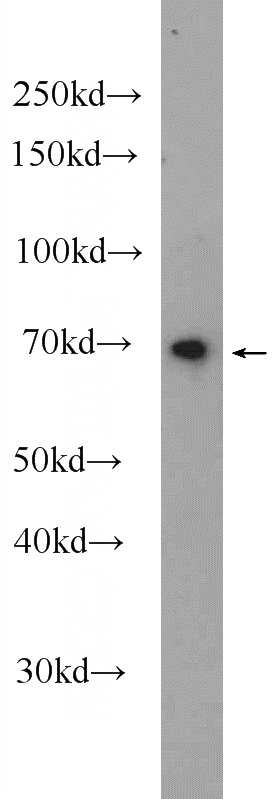mouse kidney tissue were subjected to SDS PAGE followed by western blot with Catalog No:114737(RNF112 Antibody) at dilution of 1:600