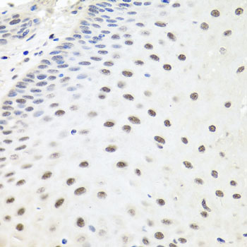 Immunohistochemistry - EXO1 Polyclonal Antibody 