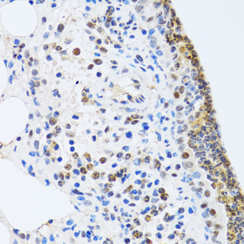 Immunohistochemistry - MTA3 Polyclonal Antibody 
