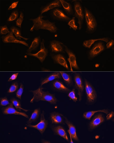 Immunofluorescence - MLPH Polyclonal Antibody 