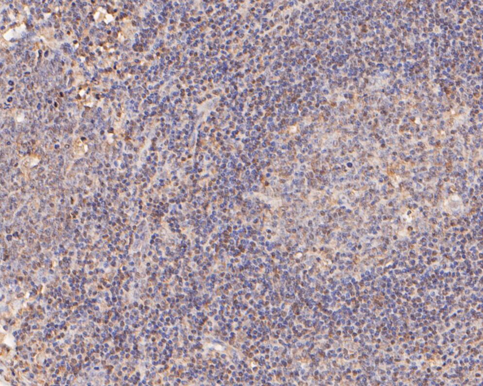 Fig5:; Immunohistochemical analysis of paraffin-embedded human tonsil tissue using anti-IL-7 antibody. The section was pre-treated using heat mediated antigen retrieval with Tris-EDTA buffer (pH 9.0) for 20 minutes.The tissues were blocked in 5% BSA for 30 minutes at room temperature, washed with ddH; 2; O and PBS, and then probed with the primary antibody ( 1/500) for 30 minutes at room temperature. The detection was performed using an HRP conjugated compact polymer system. DAB was used as the chromogen. Tissues were counterstained with hematoxylin and mounted with DPX.