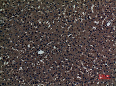 Fig2:; Immunohistochemical analysis of paraffin-embedded human-liver, antibody was diluted at 1:100