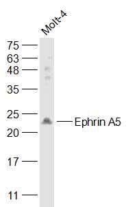 Fig1: Sample:; MOLT-4(Human) Cell Lysate at 30 ug; Primary: Anti-Ephrin A5 at 1/1000 dilution; Secondary: IRDye800CW Goat Anti-Rabbit IgG at 1/20000 dilution; Predicted band size: 24 kD; Observed band size: 23 kD
