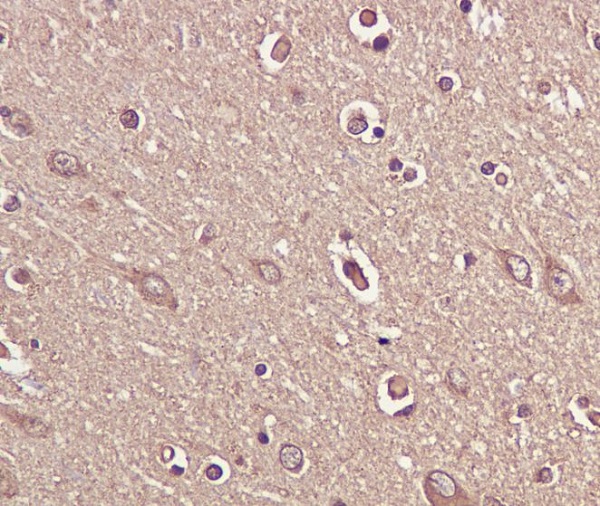 Immunohistochemical analysis of paraffin-embedded human brain, using BDNF Antibody.
