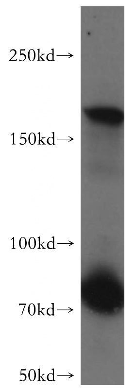 mouse brain tissue were subjected to SDS PAGE followed by western blot with Catalog No:112490(MAST1 antibody) at dilution of 1:300