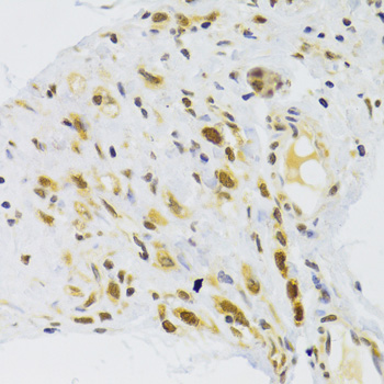 Immunohistochemistry - RPL13 Polyclonal Antibody 