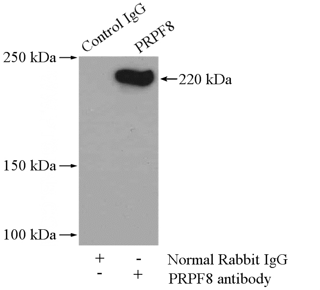 IP Result of anti-PRPF8 (IP:Catalog No:114235, 4ug; Detection:Catalog No:114235 1:500) with HeLa cells lysate 2000ug.