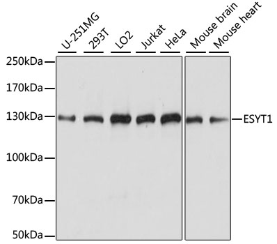 Western blot - ESYT1 Polyclonal Antibody 