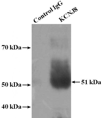 IP Result of anti-KCNJ8 (IP:Catalog No:112066, 4ug; Detection:Catalog No:112066 1:300) with mouse spleen tissue lysate 4000ug.