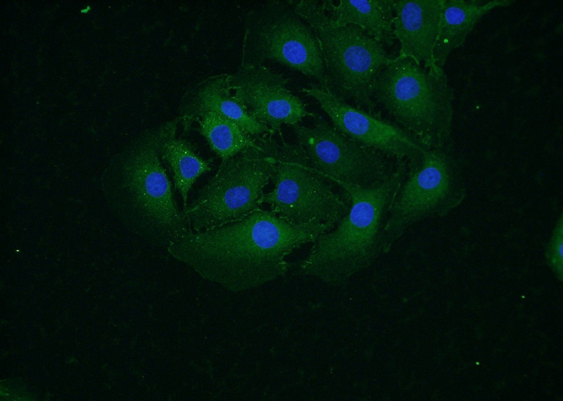 Immunofluorescent analysis of SH-SY5Y cells using Catalog No:107872(CTNNA2 Antibody) at dilution of 1:50 and Alexa Fluor 488-congugated AffiniPure Goat Anti-Rabbit IgG(H+L)
