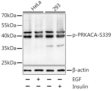 Western blot - Phospho-PRKACA-S339 pAb 