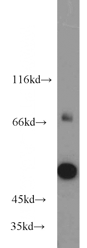 mouse brain tissue were subjected to SDS PAGE followed by western blot with Catalog No:111490(HMMR-Specific antibody) at dilution of 1:800