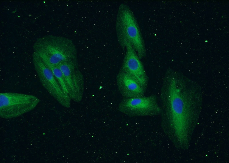 Immunofluorescent analysis of A549 cells using Catalog No:110243(EML4 Antibody) at dilution of 1:50 and Alexa Fluor 488-congugated AffiniPure Goat Anti-Rabbit IgG(H+L)