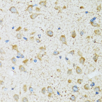Immunohistochemistry - COG2 Polyclonal Antibody 