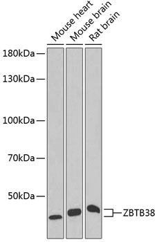 Western blot - ZBTB38 Polyclonal Antibody 