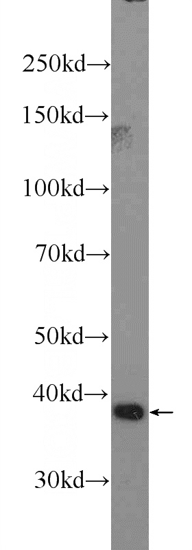HepG2 cells were subjected to SDS PAGE followed by western blot with Catalog No:111492(HMOX2 Antibody) at dilution of 1:600