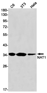 Western blot detection of NAT1 in C6,3T3,Hela cell lysates using NAT1 Rabbit mAb(1:1000 diluted).Predicted band size:34kDa.Observed band size:34kDa.