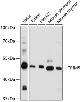 Western blot - TRIM5 Polyclonal Antibody 