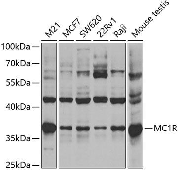 Western blot - MC1R Polyclonal Antibody 