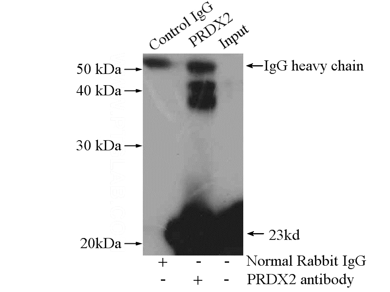 IP Result of anti-PRDX2 (IP:Catalog No:113721, 4ug; Detection:Catalog No:113721 1:1000) with HEK-293 cells lysate 2800ug.