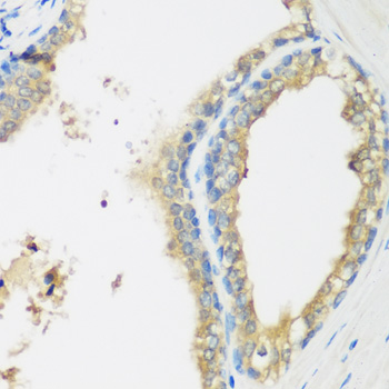 Immunohistochemistry - WDR77 Polyclonal Antibody 