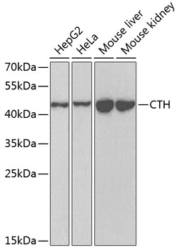 Western blot - CTH Polyclonal Antibody 