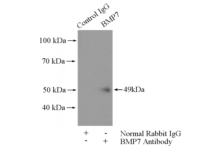 IP Result of anti-BMP7 (IP:Catalog No:117200, 4ug; Detection:Catalog No:117200 1:800) with HEK-293 cells lysate 2800ug.