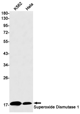 Western blot detection of Superoxide Dismutase 1 in K562,Hela cell lysates using Superoxide Dismutase 1 Rabbit mAb(1:1000 diluted).Predicted band size:16kDa.Observed band size:16kDa.