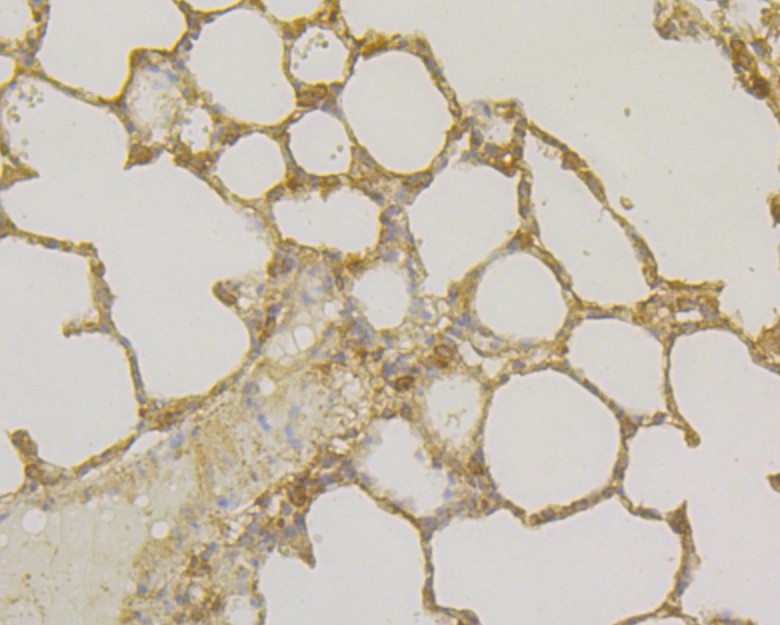 Fig3: Immunohistochemical analysis of paraffin-embedded rat lung tissue using anti-Osteoprotegerin antibody. Counter stained with hematoxylin.