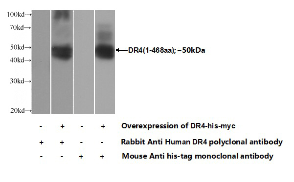 Transfected HEK-293 cells were subjected to SDS PAGE followed by western blot with Catalog No:110012(DR4 Antibody) at dilution of 1:20000