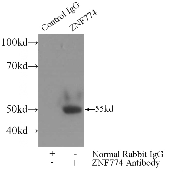 IP Result of anti-ZNF774 (IP:Catalog No:117033, 3ug; Detection:Catalog No:117033 1:600) with HepG2 cells lysate 2400ug.