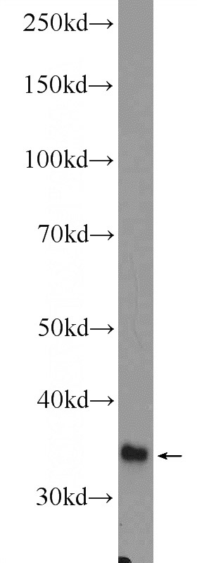 mouse liver tissue were subjected to SDS PAGE followed by western blot with Catalog No:111082(GLYAT Antibody) at dilution of 1:600
