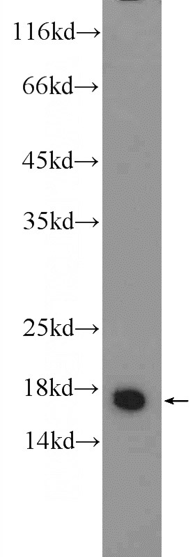 rat brain tissue were subjected to SDS PAGE followed by western blot with Catalog No:111098(GMFB Antibody) at dilution of 1:500