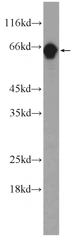 human testis tissue were subjected to SDS PAGE followed by western blot with Catalog No:110639(FGFBP3 Antibody) at dilution of 1:300
