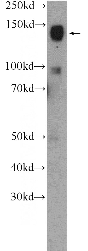mouse brain tissue were subjected to SDS PAGE followed by western blot with Catalog No:109230(CHL1 Antibody) at dilution of 1:600