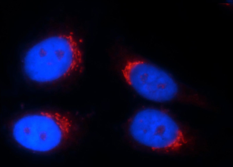 Immunofluorescent analysis of HepG2 cells using Catalog No:116102(TMEM165 Antibody) at dilution of 1:100 and Rhodamine-labeled goat anti-rabbit IgG