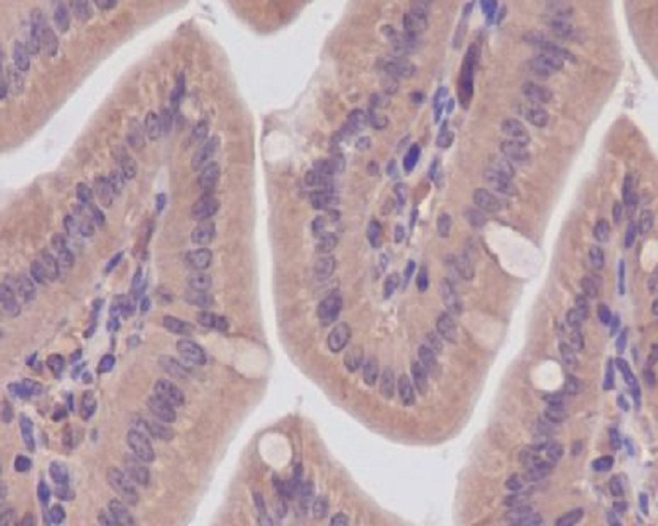 Immunohistochemical analysis of paraffin-embedded mouse colon, using CaMKII Antibody.
