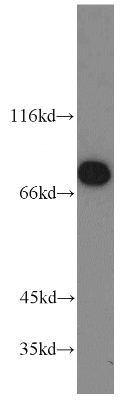 HepG2 cells were subjected to SDS PAGE followed by western blot with Catalog No:114006(PLOD3 antibody) at dilution of 1:800