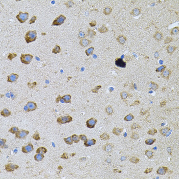Immunohistochemistry - PFKP Polyclonal Antibody 