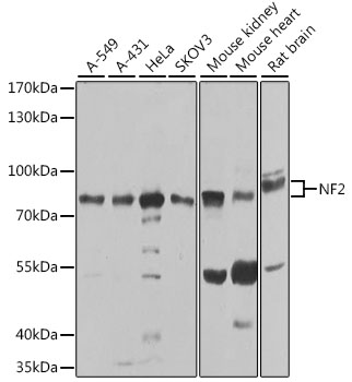 Western blot - NF2 Polyclonal Antibody 