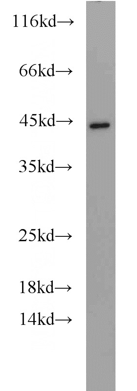 Y79 cells were subjected to SDS PAGE followed by western blot with Catalog No:114643(RGS16 antibody) at dilution of 1:500