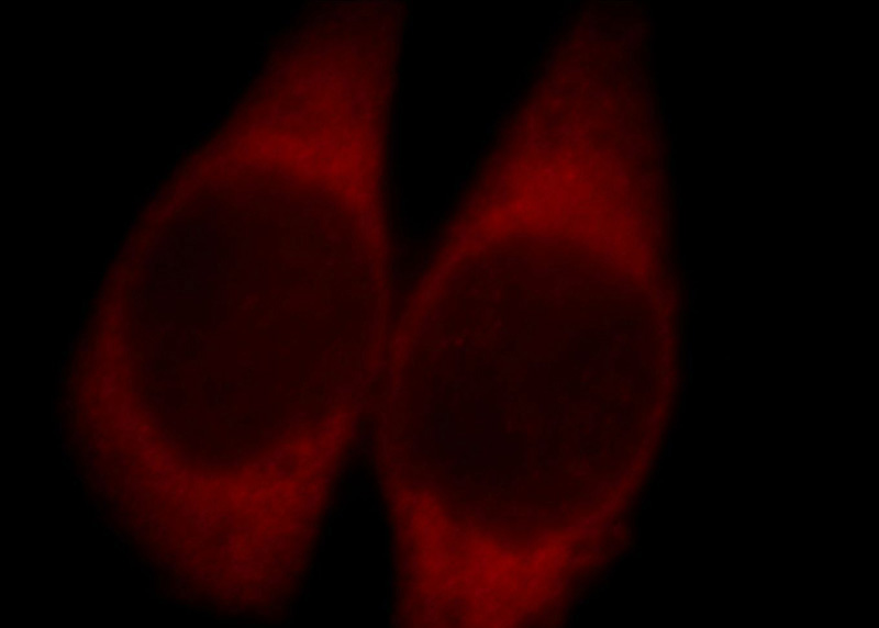 Immunofluorescent analysis of Hela cells, using ABI2 antibody Catalog No:107817 at 1:25 dilution and Rhodamine-labeled goat anti-rabbit IgG (red).