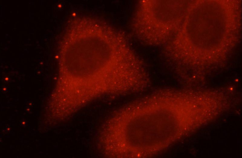 Immunofluorescent analysis of HepG2 cells using Catalog No:111796(ING4-specific Antibody) at dilution of 1:25 and Rhodamine-Goat anti-Rabbit IgG