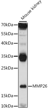Western blot - MMP26 Polyclonal Antibody 