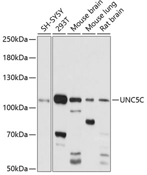 Western blot - UNC5C Polyclonal Antibody 